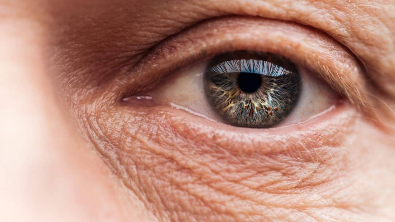 Signs and Symptoms of Cataracts